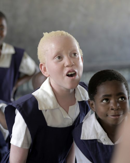 말라위: 2살된 알비노 어린이 살해, 보호받지 못하는 취약 집단