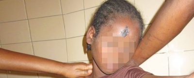 중앙아프리카공화국: 참상 속에서 살아남은 생명